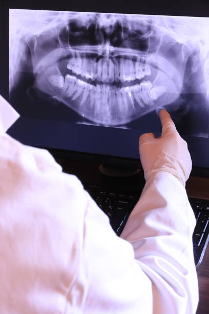 Best Emergency Dental Extractions in St Paul, TX